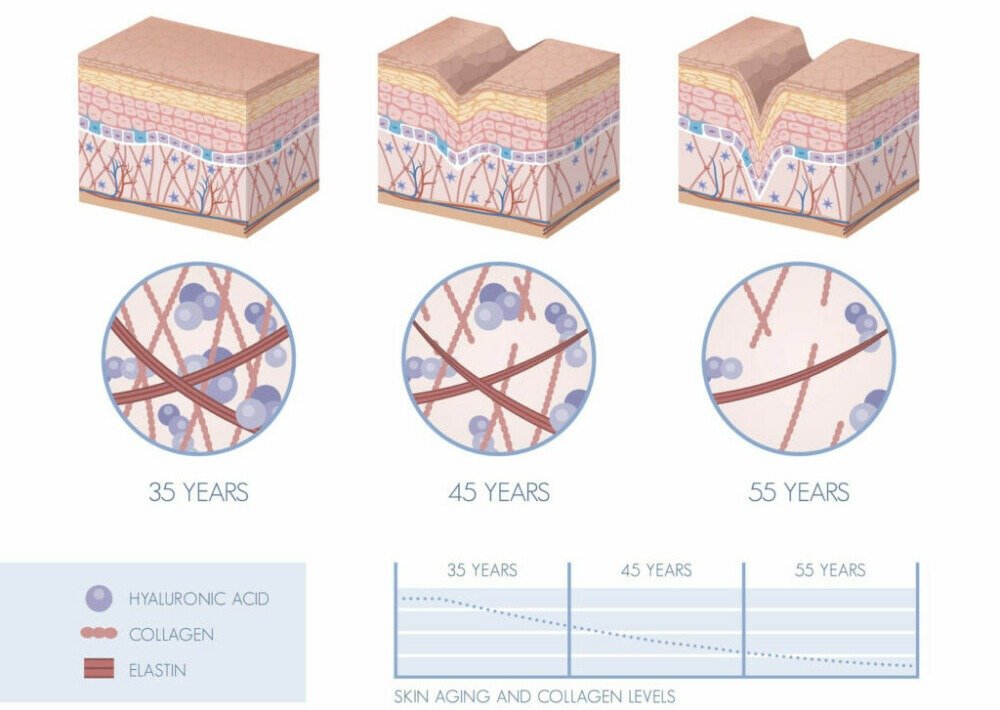 Collagen Decline With Age