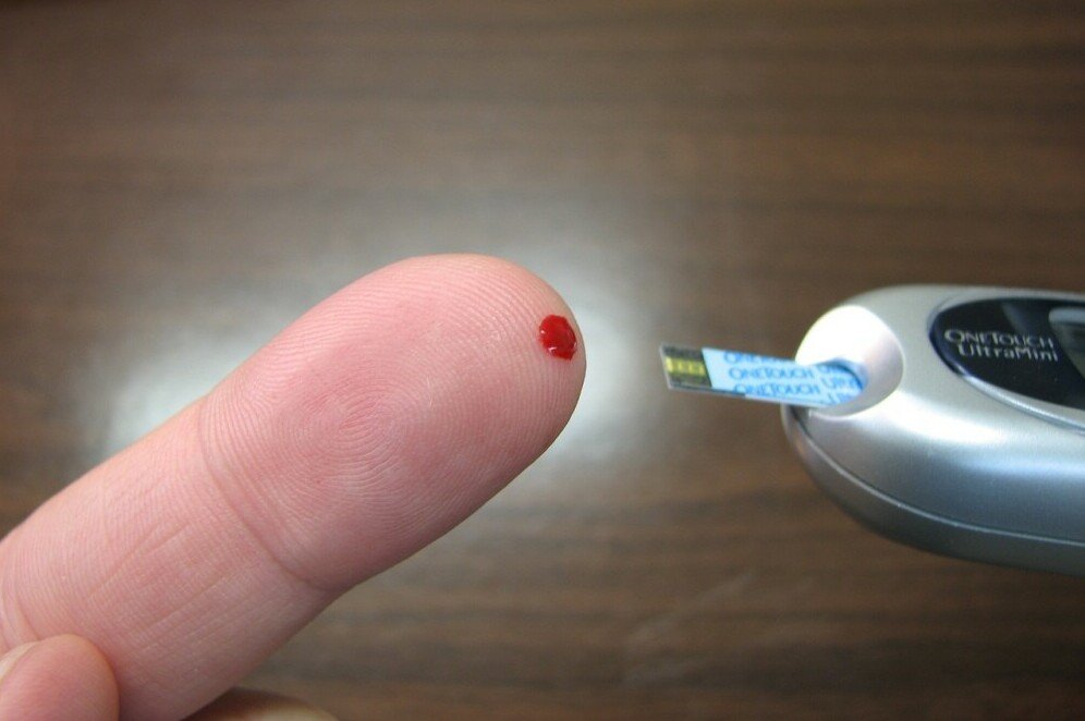 Glucose Levels